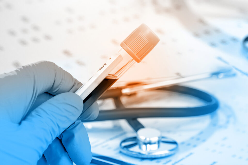 Quel est le meilleur test ADN de parenté ?